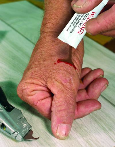 Contractingbusiness Com Sites Contractingbusiness com Files Uploads 2013 09 Wound Seal Stops Bleeding Instantly 0