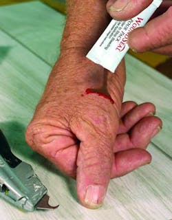 Contractingbusiness Com Sites Contractingbusiness com Files Uploads 2013 09 Wound Seal Stops Bleeding Instantly 0 Contractingbusiness Com Sites Contractingbusiness com Files Uploads 2013 09 Wound Seal Stops Bleeding Instantly 0